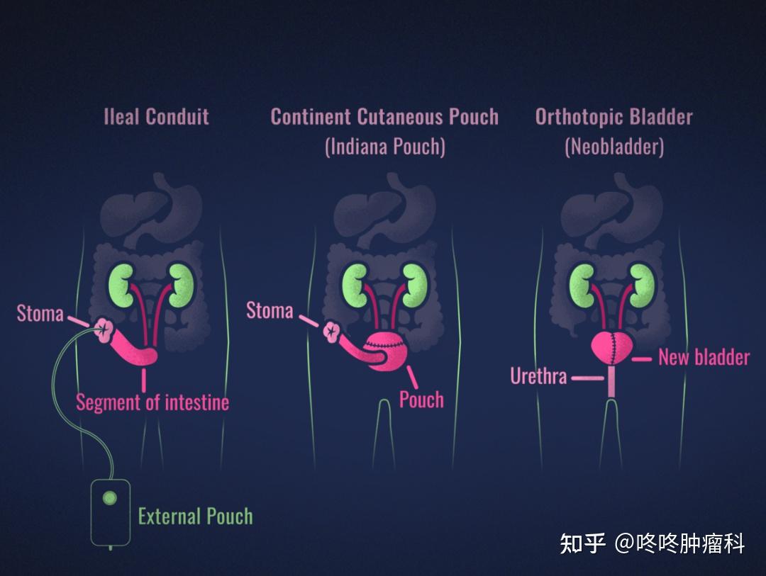 最新尿疗法，探索未来医学的新领域突破